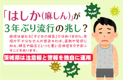 はしか（麻疹）蔓延の兆し、茨城県が独自に“注意報”“警報”の運用開始